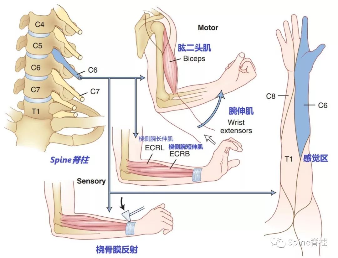 手麻、颈痛？一文读懂最常见的神经根型颈椎病！