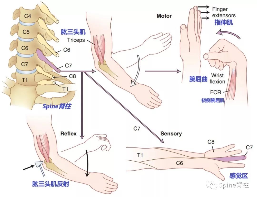 手麻、颈痛？一文读懂最常见的神经根型颈椎病！