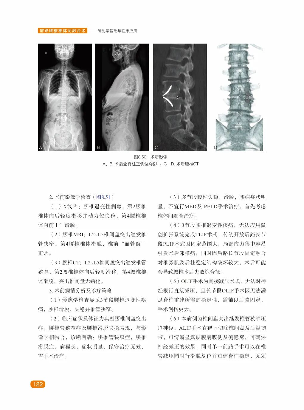 新书首发｜前路腰椎椎体间融合术——解剖学基础与临床应用