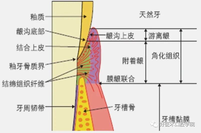 冠延长手术如何做，看完这篇手术思路更清晰！