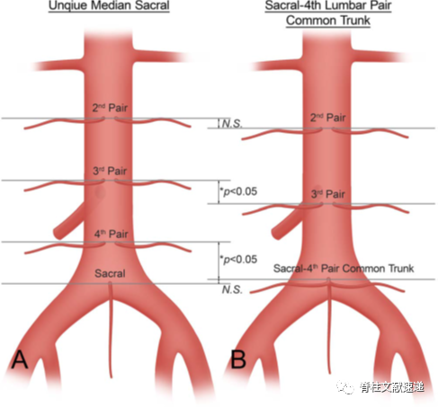 腰椎重要节段血管解剖，你弄清楚了吗？