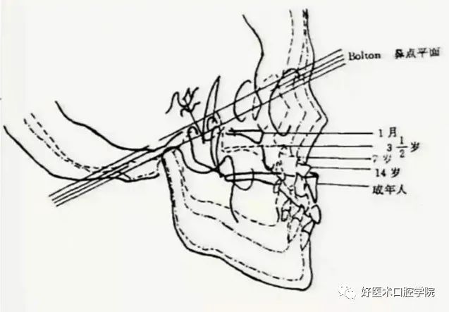 一文快速了解颅面部的生长发育与青春高峰期，正畸医生必知！