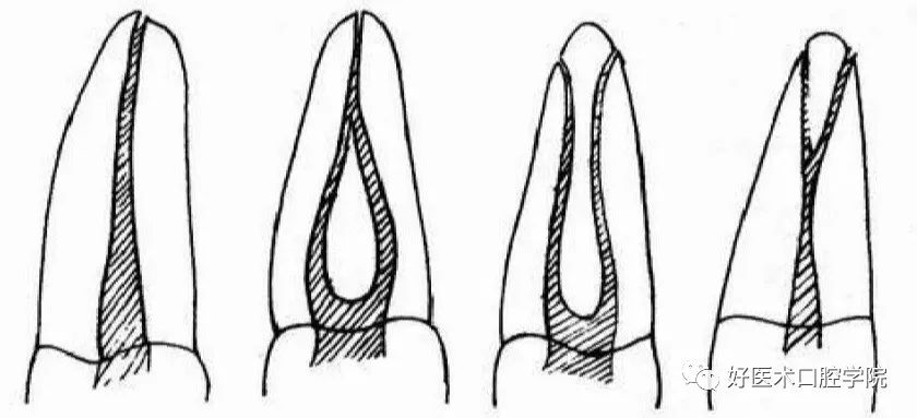 根管解剖详细数据，整理好了随时来看!