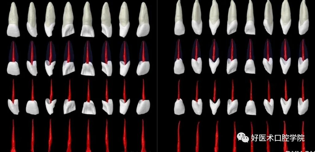 根管解剖详细数据，整理好了随时来看!