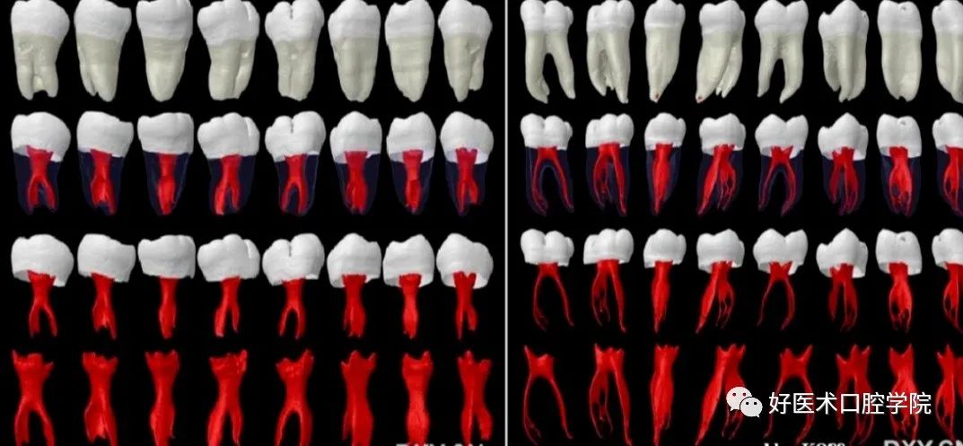 根管解剖详细数据，整理好了随时来看!