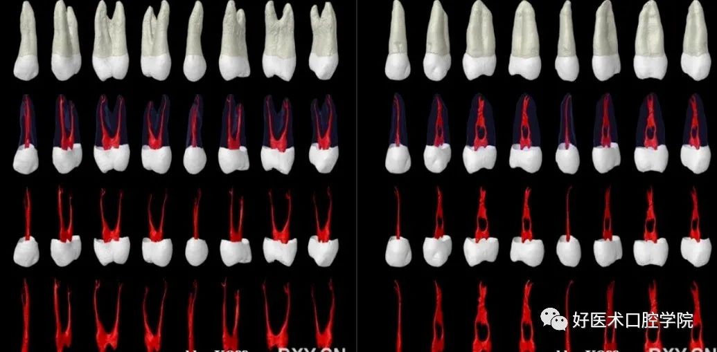 根管解剖详细数据，整理好了随时来看!