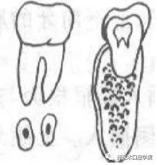 一文帮你记住各类牙拔除方法，提升拔牙技术！