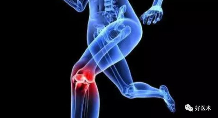 膝关节为什么有积液，一定要抽出来吗？