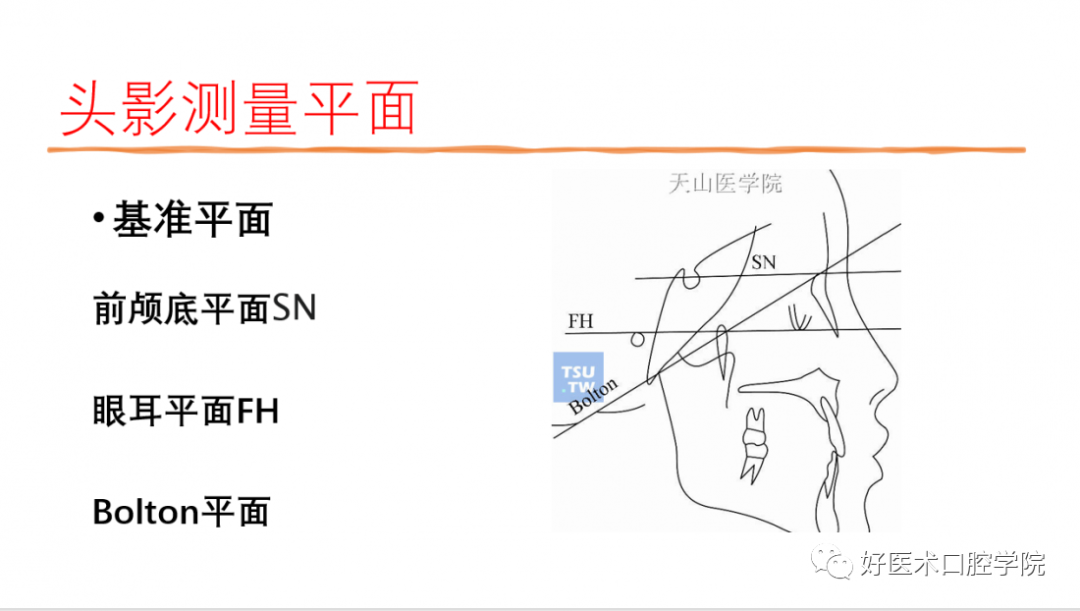 颅底角测量图片