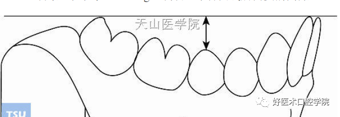 一篇很全的正畸基础知识，看完就能记住！