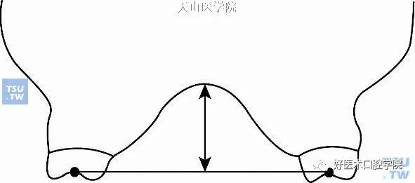 一篇很全的正畸基础知识，看完就能记住！