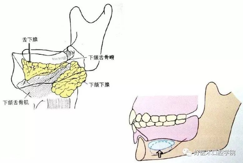 颊系带修整术过程图解图片