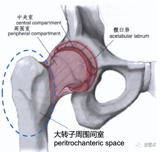 做好髋关节镜手术，请收下这份解析说明！