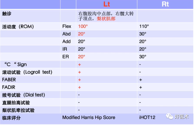 做好髋关节镜手术，请收下这份解析说明！