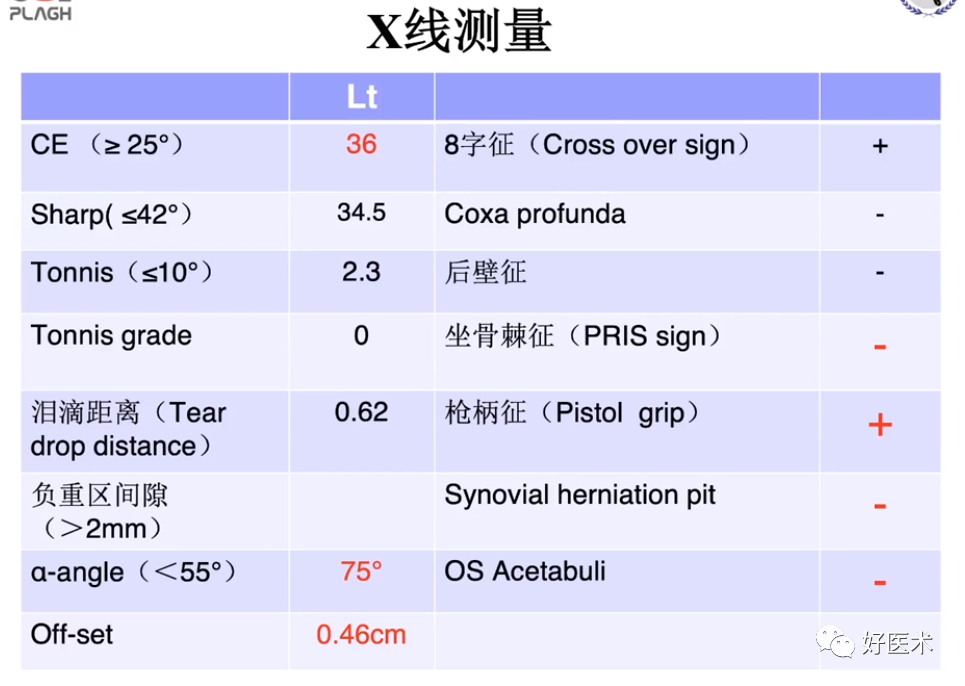 做好髋关节镜手术，请收下这份解析说明！