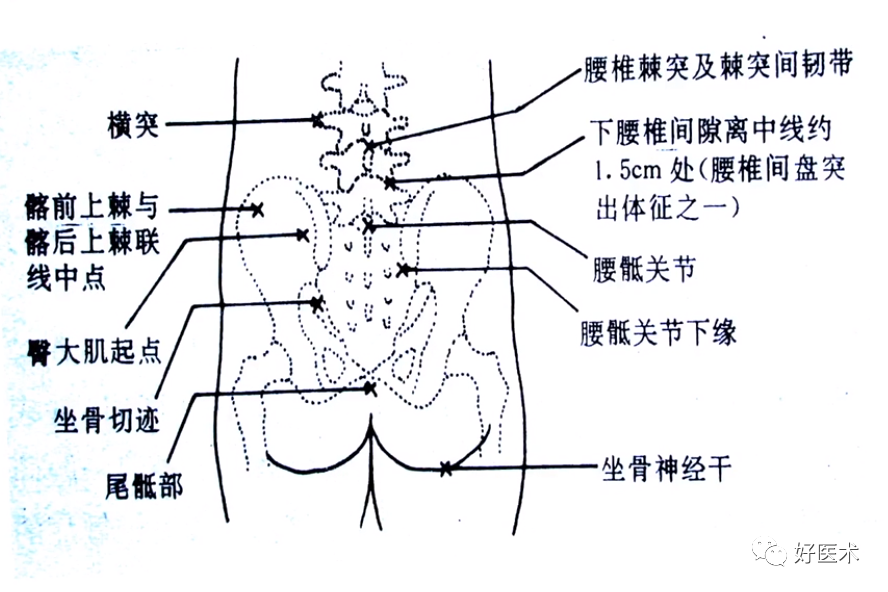 做好髋关节镜手术，请收下这份解析说明！