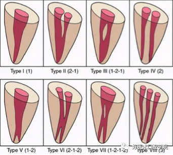一文解读：乳牙根管治疗，适应症选择很重要!