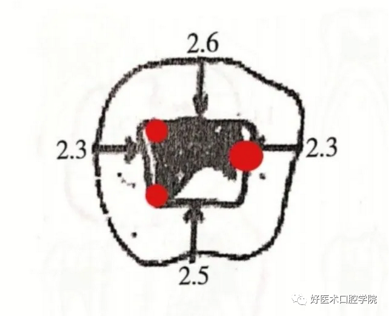 一文解读：乳牙根管治疗，适应症选择很重要!