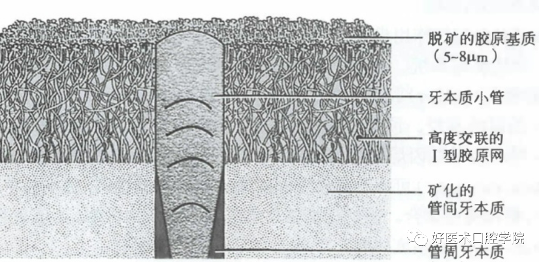 一文教你从根本理解口腔粘接系统，这个知识你必须看看了!