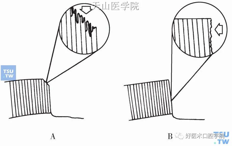 一文教你从根本理解口腔粘接系统，这个知识你必须看看了!