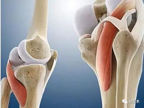 肿痛、弹响、打软腿、运动障碍？高度警惕膝关节软骨的损伤！