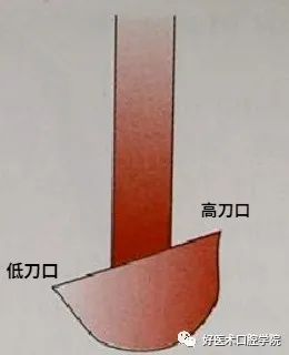 牙周刮治技术，从检查到操作方法，全套要点总结！