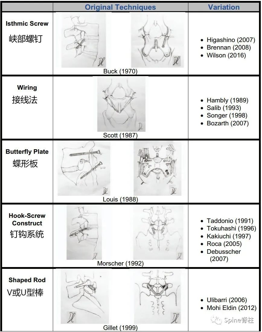 腰椎峡部裂修补固定术，这些方案你都会吗？