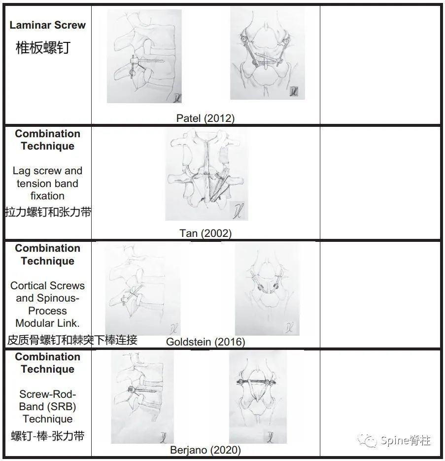 腰椎峡部裂修补固定术，这些方案你都会吗？
