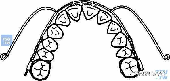 牙量与骨量不调的正畸矫正