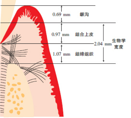 全瓷冠牙体预备，口腔人的工匠精神，先学习后实践！