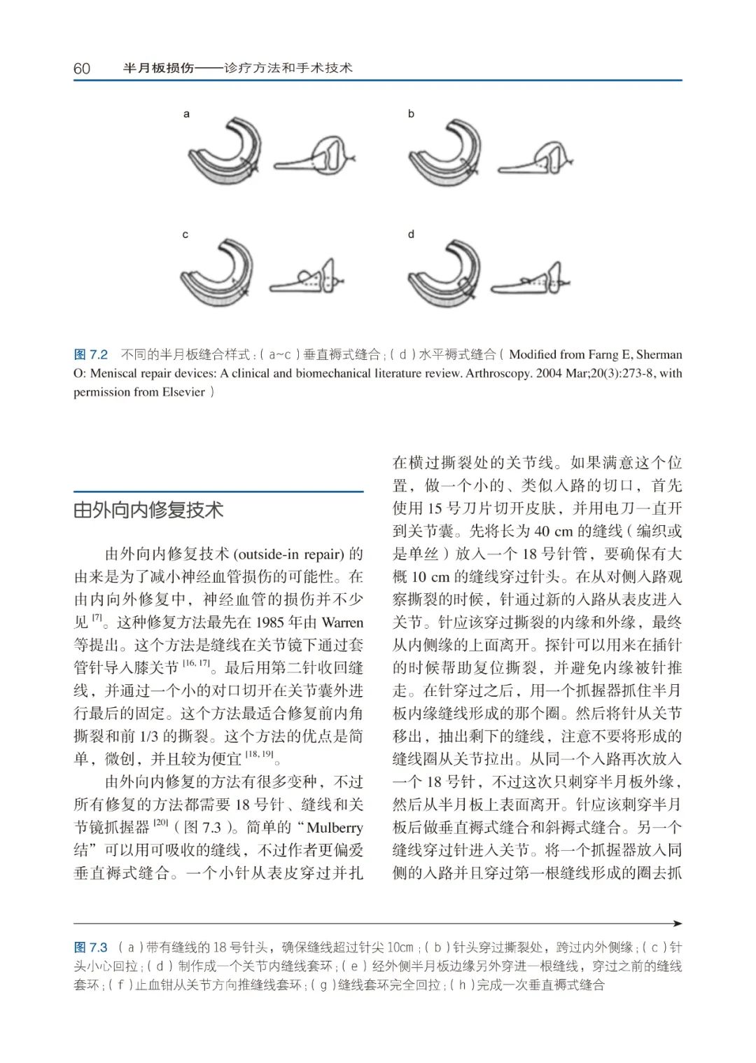 关于半月板损伤修复，骨科医生需要学习的资料书！