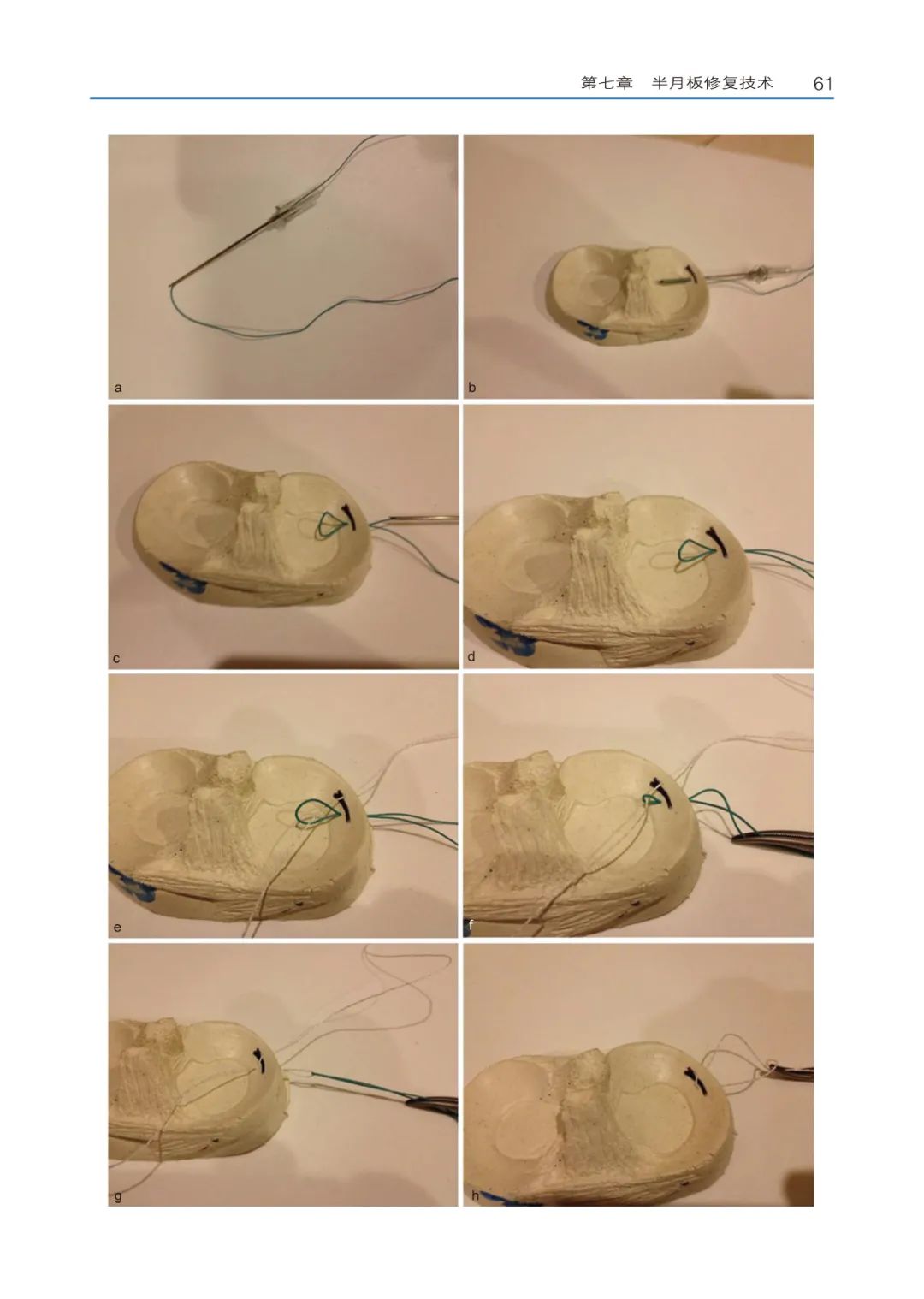 关于半月板损伤修复，骨科医生需要学习的资料书！