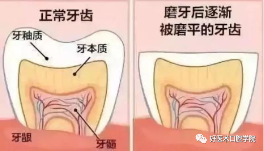 5分钟，教你快速搞定头疼的牙齿敏感！