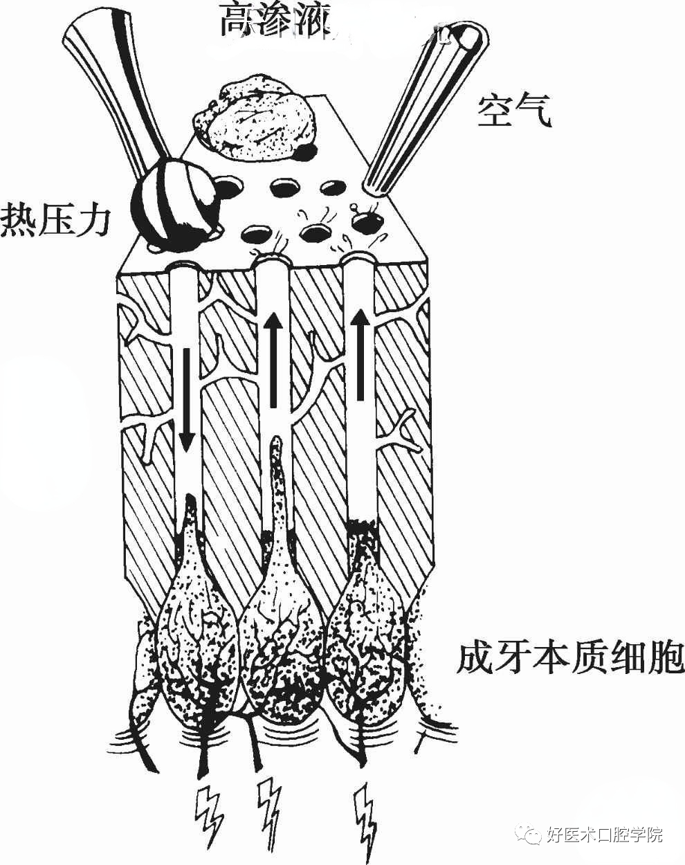 5分钟，教你快速搞定头疼的牙齿敏感！