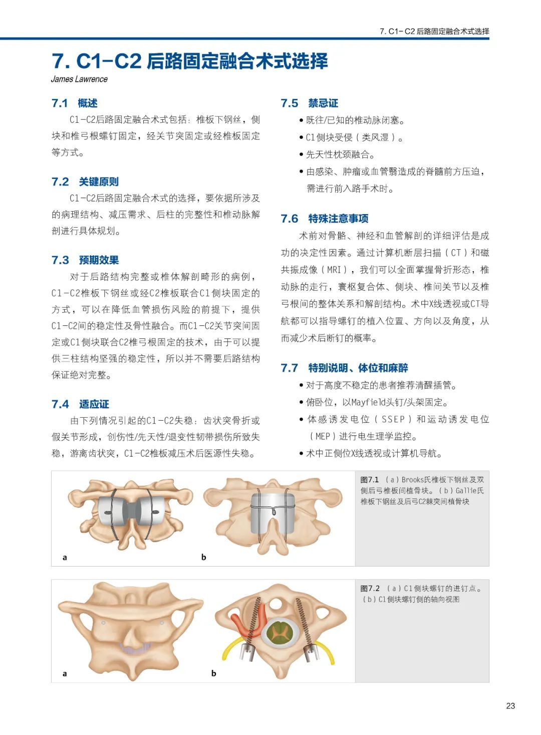 《脊柱外科手术技巧》第3版，内容全面实用！