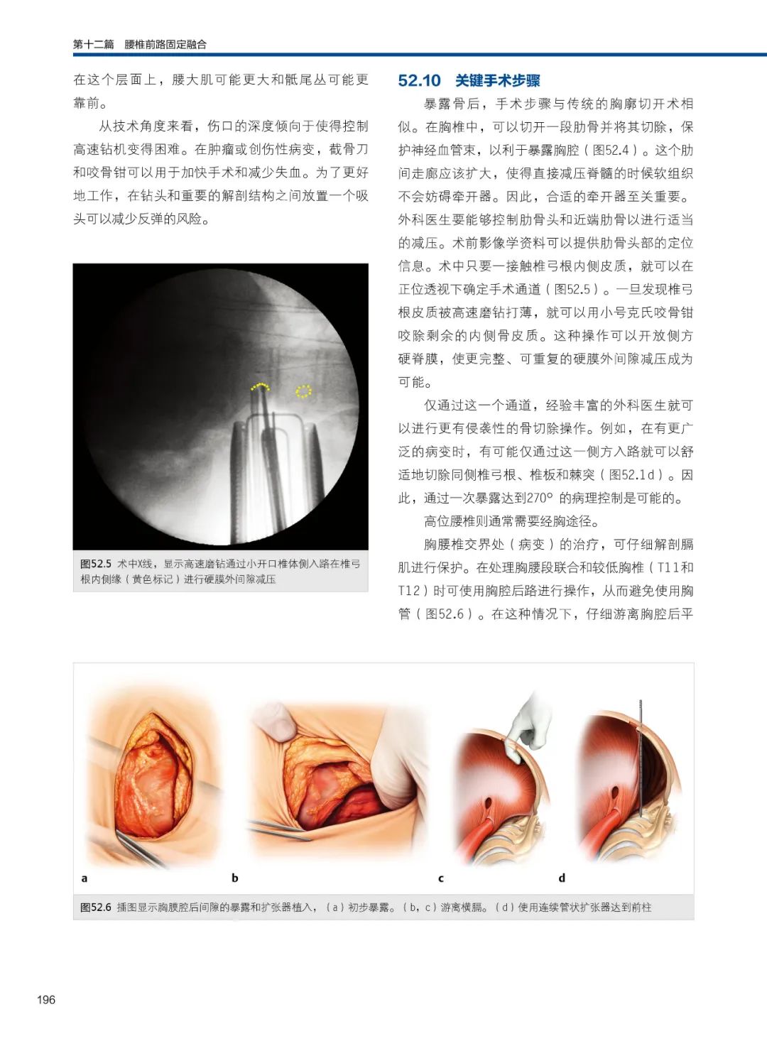 《脊柱外科手术技巧》第3版，内容全面实用！