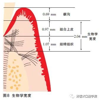 排龈线如果这样用，可以解决很多麻烦！