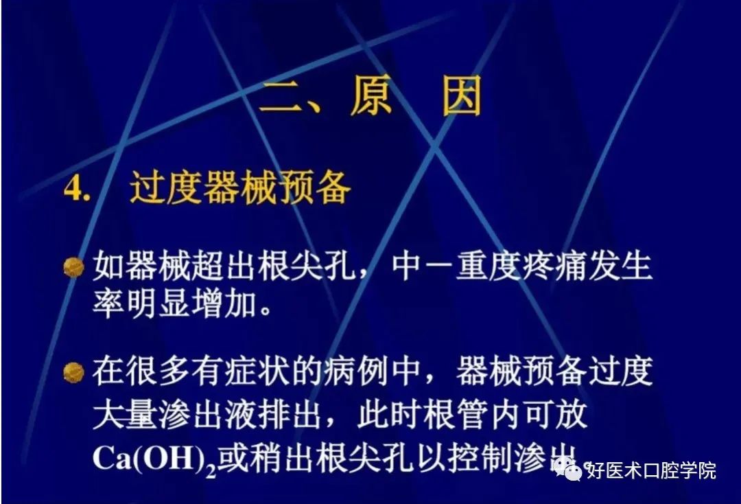 几张图明白根管治疗期间急性发作和急症处理，实用临床总结必看！