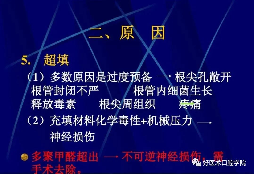 几张图明白根管治疗期间急性发作和急症处理，实用临床总结必看！