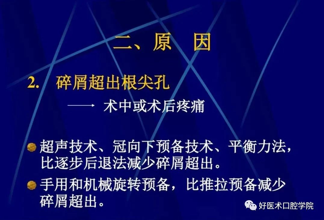 几张图明白根管治疗期间急性发作和急症处理，实用临床总结必看！