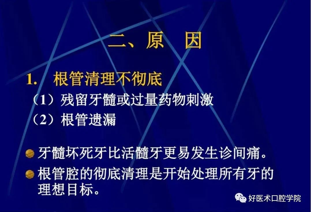 几张图明白根管治疗期间急性发作和急症处理，实用临床总结必看！