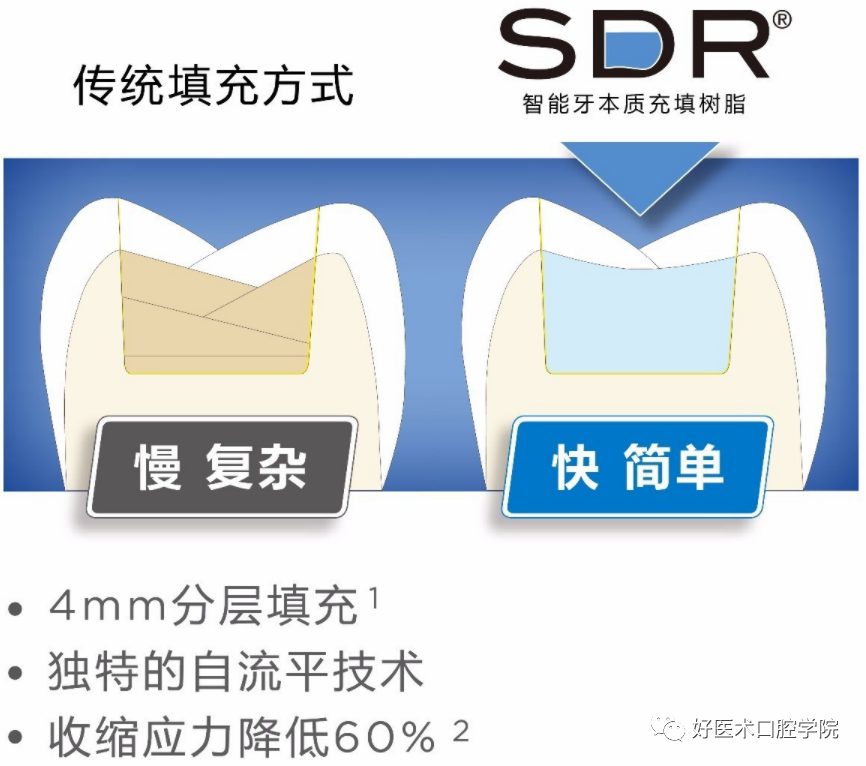 多结合面的龈壁提升靠谱吗？临床这样做更牢固！