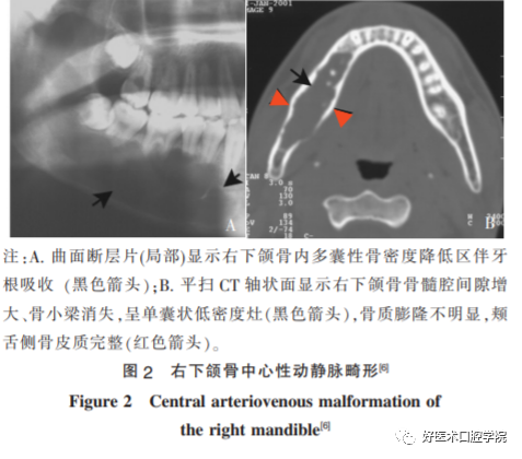 拔牙突发大出血不止，这种情况应警惕！