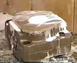 为什么我劝你不要随便做隐形义齿，答案就在这里！