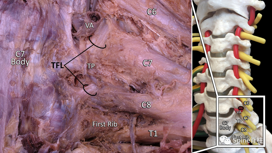 椎间孔内外韧带解剖及作用，详细解析推荐收藏！