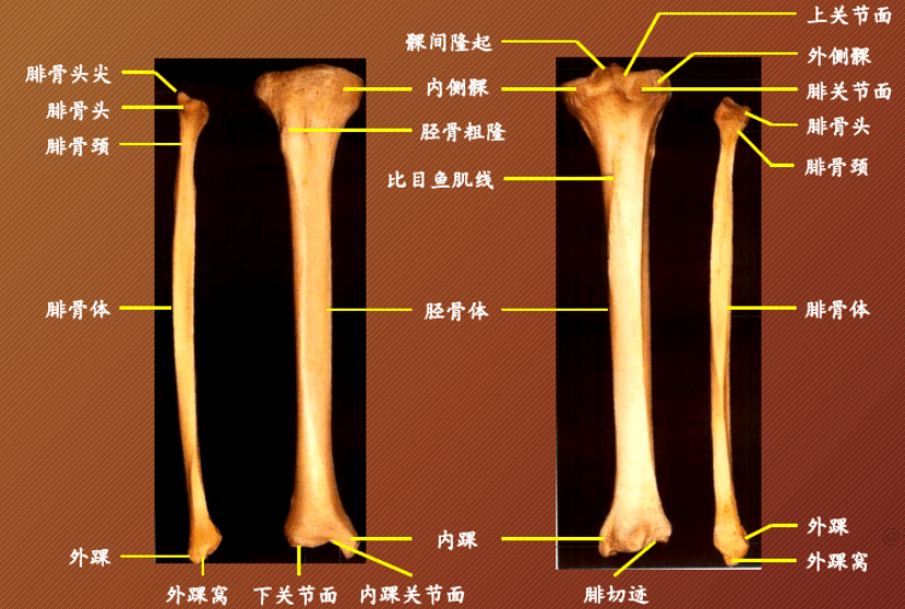 这些pilon骨折治疗知识，能获得更好效果！