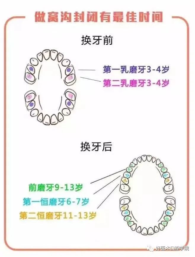 牙科医生给孩子的护牙秘籍，除了刷牙还多做了这一点！