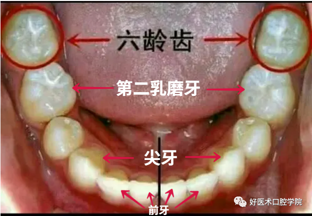 牙科医生给孩子的护牙秘籍，除了刷牙还多做了这一点！