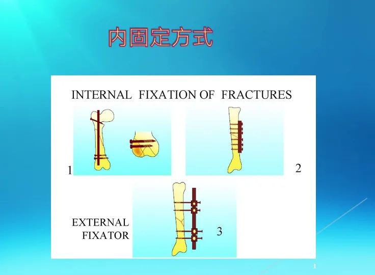 下肢骨关节损伤诊治全过程，图文解析更易懂！