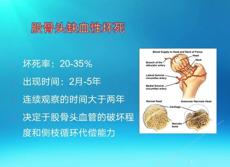 下肢骨关节损伤诊治全过程，图文解析更易懂！